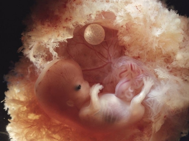 10 тиждень вагітності: що відбувається з малюком і мамою - фото1