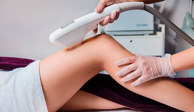 Лазерная эпиляция: что это такое, как происходит, плюсы и минусы - фото2 Лазерная эпиляция: что это такое, как происходит, плюсы и минусы - фото2