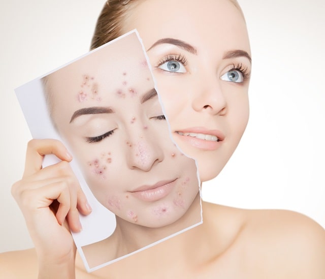 «Дерива С МS»: что это за гель, применение, отличия от «Дерива водный гель» - фото4