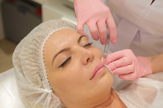 Филлеры в косметологии: что это такое, виды, кому подойдут - фото2