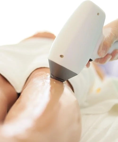 Профессиональное оборудование для лазерной эпиляции - фото3