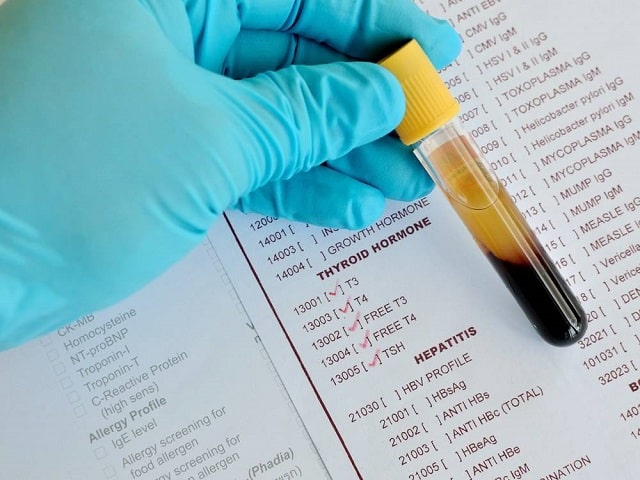 Анализ крови: виды, что показывают, как подготовиться - фото4