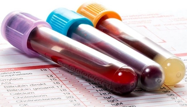 Какие бывают анализы крови - фото1 Какие бывают анализы крови - фото1