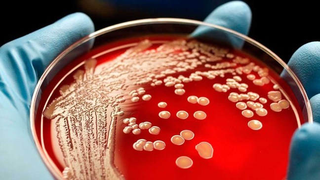 А есть ли в вашем организме золотистый стафилококк - фото1 А есть ли в вашем организме золотистый стафилококк - фото1