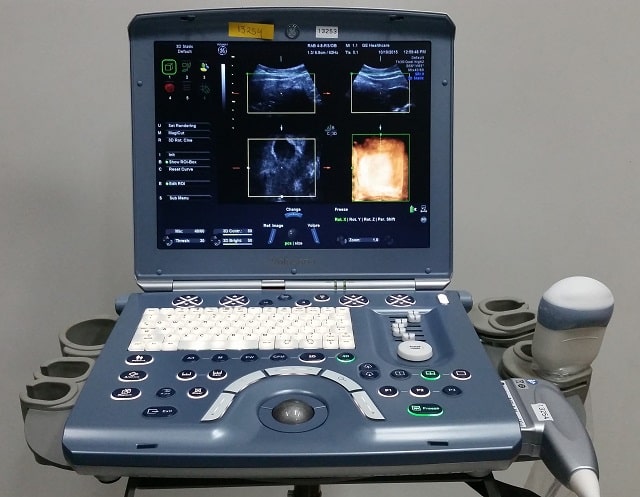 Апарат УЗД: що це таке і як працює, види та особливості - фото1 Апарат УЗД: що це таке і як працює, види та особливості - фото1