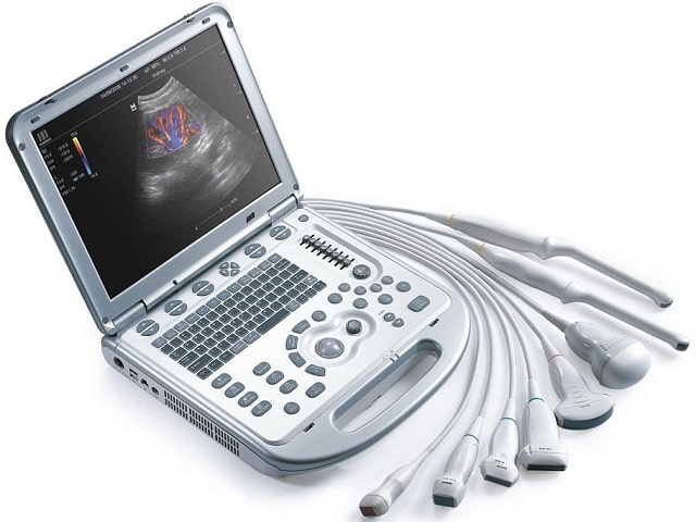 Апарат УЗД: що це таке і як працює, види та особливості - фото4 Апарат УЗД: що це таке і як працює, види та особливості - фото4