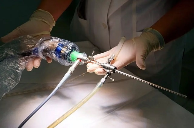 Гистероскопия матки: что это такое, как проводится, какие последствия могут быть - фото4