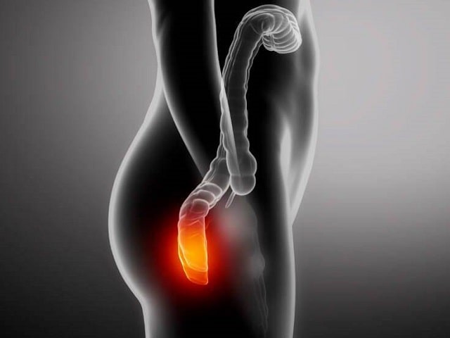 Как защититься от геморроя: причины возникновения и профилактика заболевания - фото1 Как защититься от геморроя: причины возникновения и профилактика заболевания - фото1