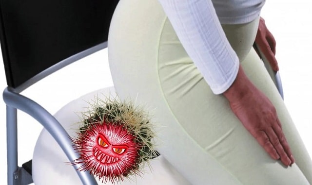 Как защититься от геморроя: причины возникновения и профилактика заболевания - фото2 Как защититься от геморроя: причины возникновения и профилактика заболевания - фото2