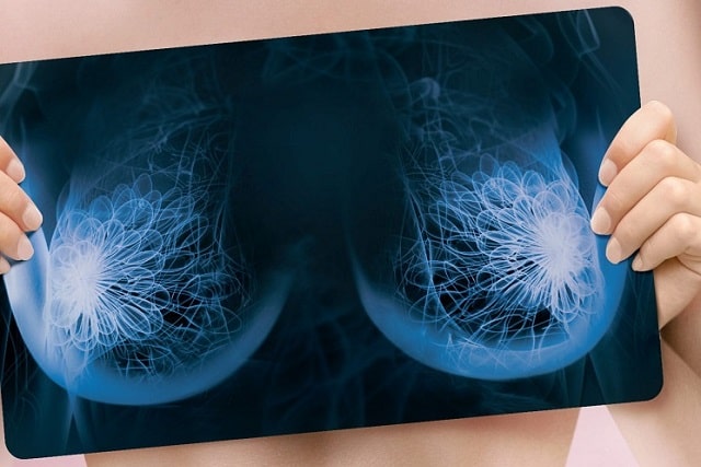 Маммолог: что это за врач, что он лечит, как часто нужно посещать - фото2 Маммолог: что это за врач, что он лечит, как часто нужно посещать - фото2