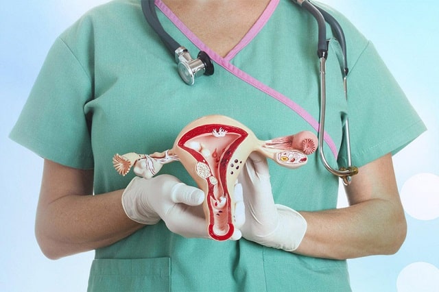 Миома матки: что это такое, виды, симптомы и причины - фото3 Миома матки: что это такое, виды, симптомы и причины - фото3