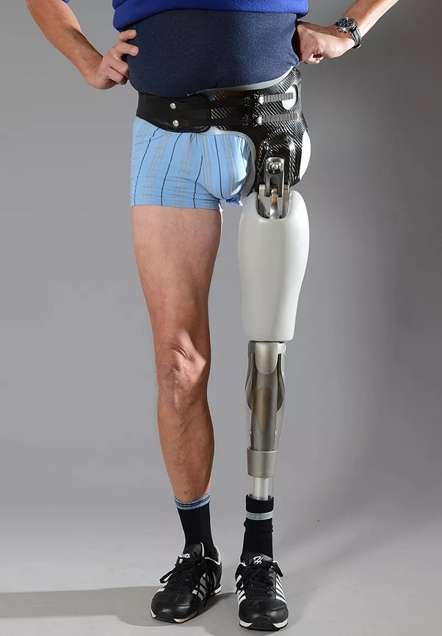 Модульний протез стегна: що це таке, види та можливості - фото2