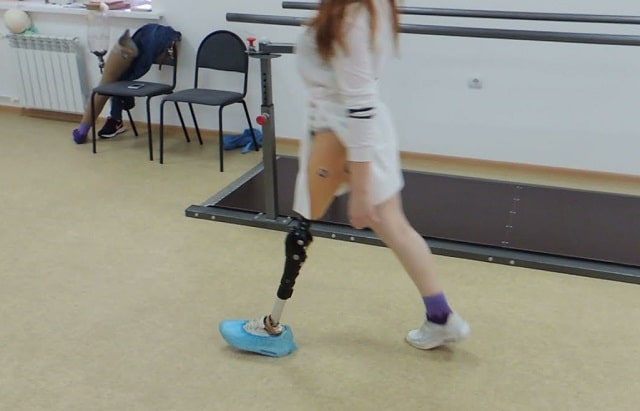 Модульний протез стегна: що це таке, види та можливості - фото3