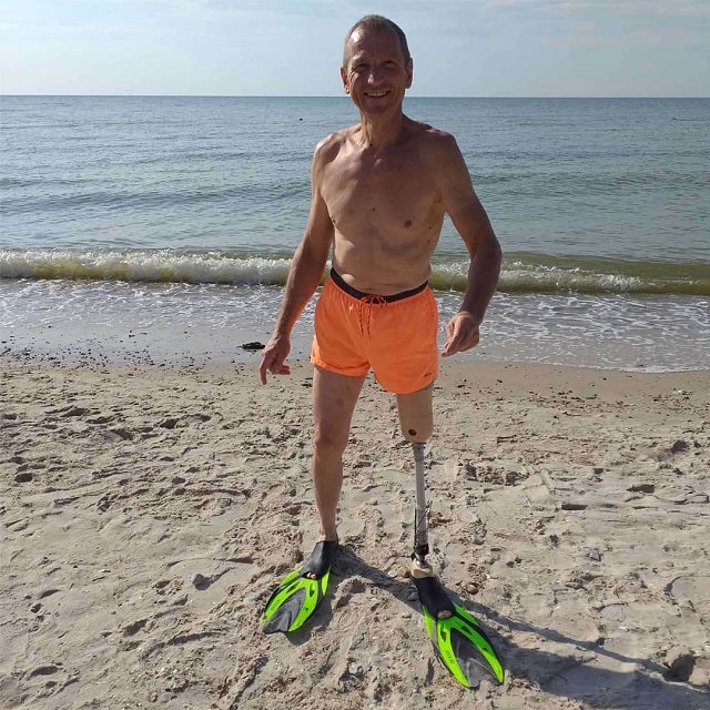 Модульний протез стегна: що це таке, види та можливості - фото4