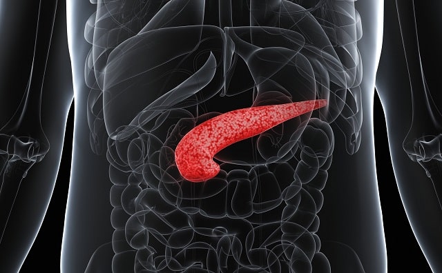 Панкреатит: что это за болезнь, причины, профилактика - фото1