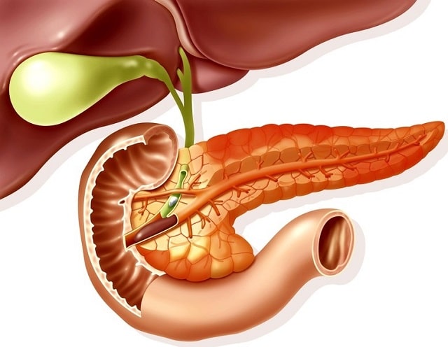 Панкреатит: что это за болезнь, причины, профилактика - фото3