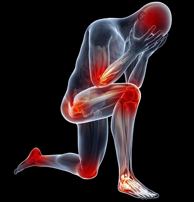 Противовоспалительные препараты: что это такое, виды, применение - фото1