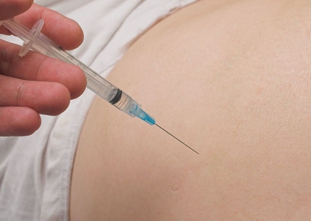 Противовоспалительные препараты: что это такое, виды, применение - фото4