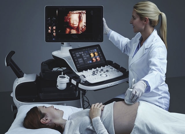 Сучасний апарат УЗД: можливості, особливості та застосування - фото2