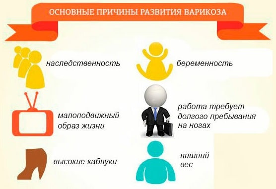 Варикоз: что это такое (симптомы, причины, профилактика) - фото3