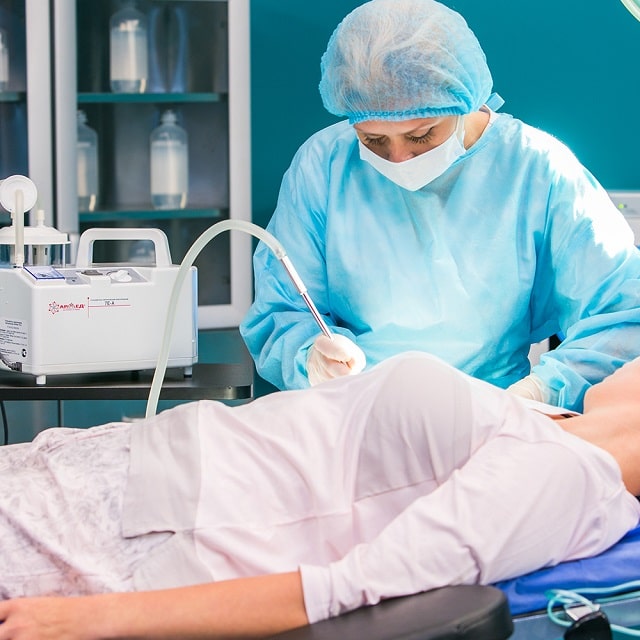 Відсмоктувач хірургічний (аспіратор): що це таке, види, застосування - фото3