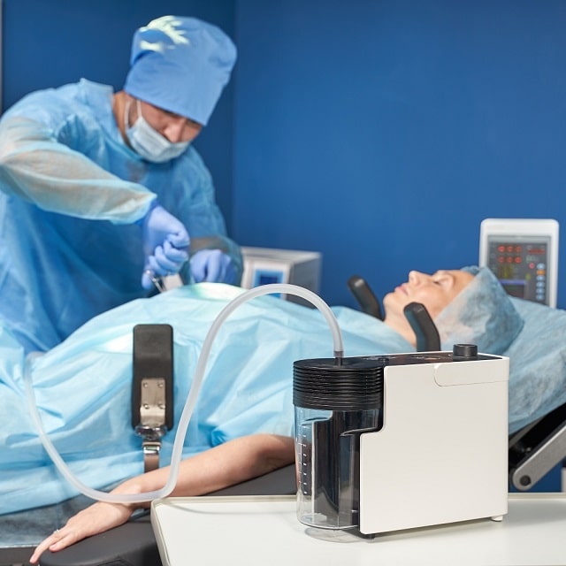 Відсмоктувач хірургічний (аспіратор): що це таке, види, застосування - фото4