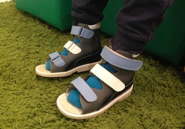 Ортопедическая обувь для детей: что это такое, как правильно подобрать - фото3 Ортопедическая обувь для детей: что это такое, как правильно подобрать - фото3