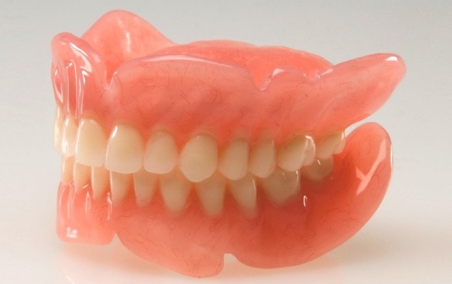 Виды протезирования зубов: какой протез лучше - фото1