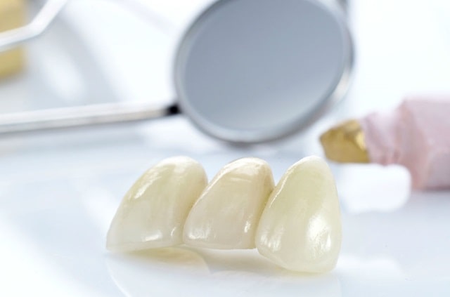 Адгезивні системи в стоматології: що це таке, види, застосування - фото1