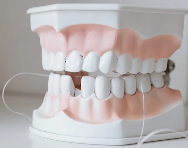 Адгезивні системи в стоматології: що це таке, види, застосування - фото4