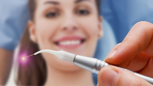 Лазер стоматологический: что это такое, виды, применение - фото1