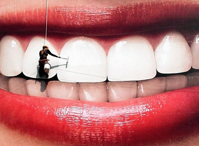 Отбеливание зубов: виды, методики, противопоказания - фото1 Отбеливание зубов: виды, методики, противопоказания - фото1