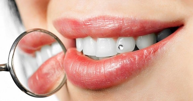 Стоматология «Bella Vista» в Харькове: красивая улыбка от профессионалов - фото1