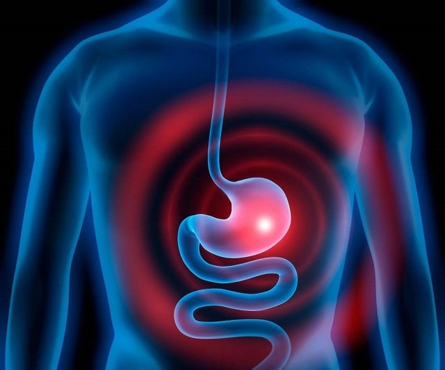 Что такое гастрит: виды, симптомы, профилактика - фото3 Что такое гастрит: виды, симптомы, профилактика - фото3