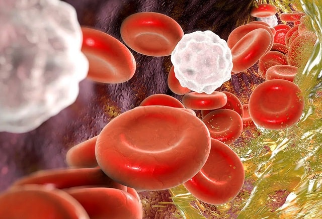 Гиперлипидемия: что это такое, причины, симптомы, профилактика - фото1