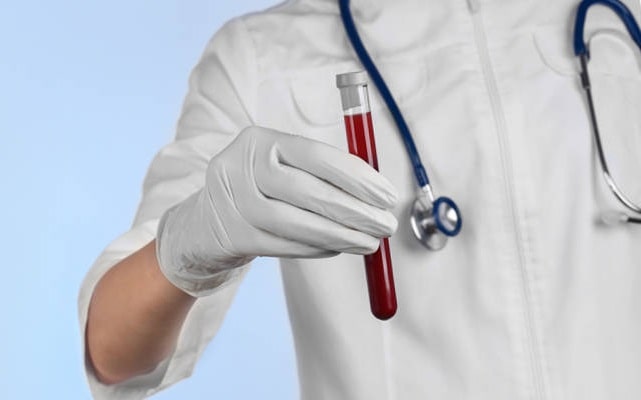 Густая кровь: что это значит, причины, симптомы, профилактика - фото3 Густая кровь: что это значит, причины, симптомы, профилактика - фото3