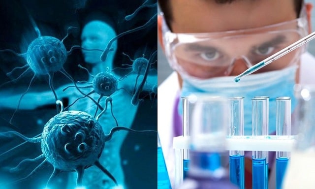 Онкология: что это такое, как выявить на ранней стадии, профилактика - фото3 Онкология: что это такое, как выявить на ранней стадии, профилактика - фото3