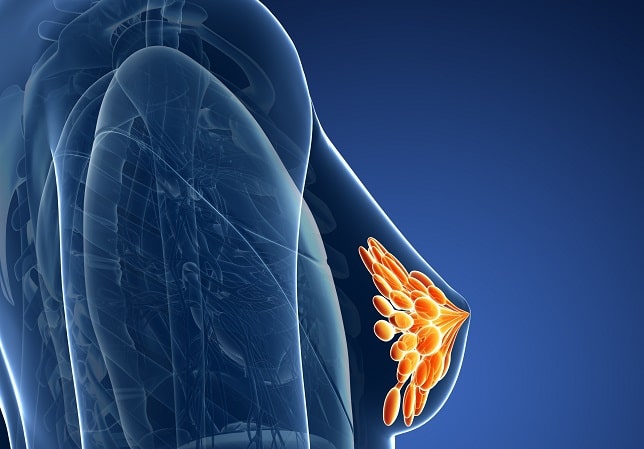 Рак груди у женщин: стадии, симптомы, как распознать - фото4