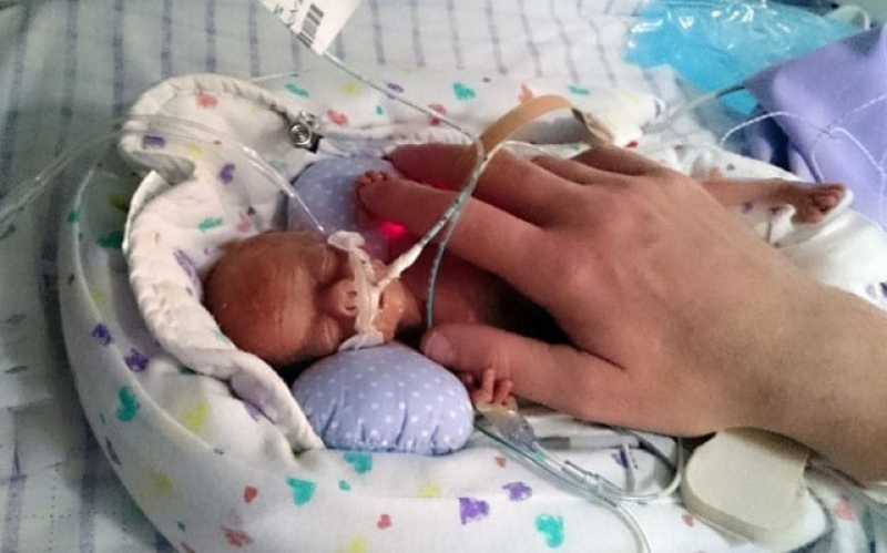 Уже через месяц в Харькове откроют отделение для выхаживания деток, родившихся с весом от 500 г