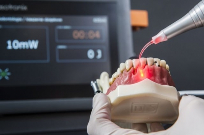 Лазер стоматологический: что это такое, виды, применение