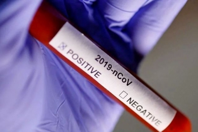 Еще в одном районе области зафиксирован коронавирус