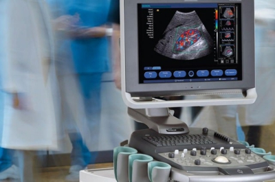 Сучасний апарат УЗД: можливості, особливості та застосування