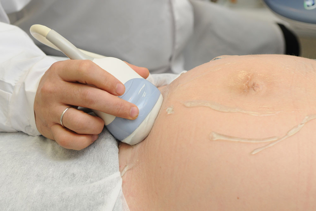 Троих акушеров-гинекологов обвиняют в смерти нерожденной двойни