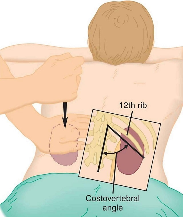 Симптом Пастернацкого: загадочные проявления и медицинские аспекты