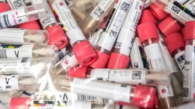 На Харьковщине обнаружен цех по изготовлению нелегальных тест-систем на коронавирус