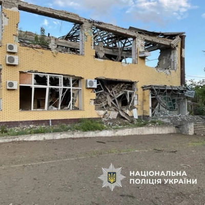 Пятеро человек в течении суток были ранены во время вражеских обстрелов