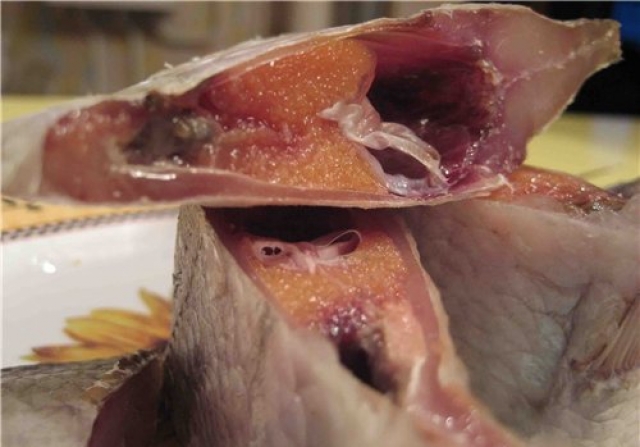 От ботулизма в областной больнице скончался мужчина, за жизнь его жены борются врачи