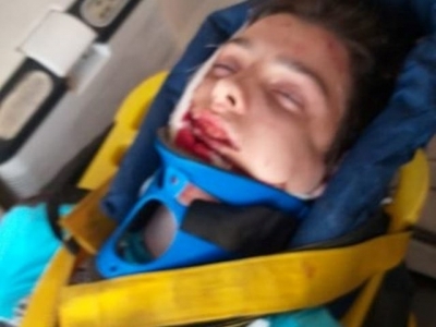 Под Харьковом подросток сорвался с железнодорожного моста