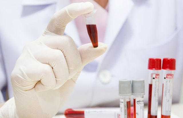 Онкодиагностика в Украине: какие возможности имеют современные лаборатории