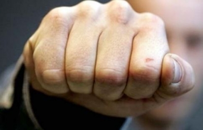 Мужчина избил товарища и угнал его авто